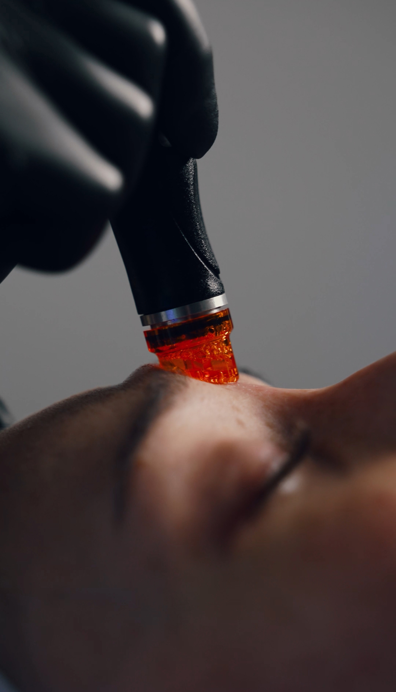 Close-up of a person receiving a hydrafacial treatment with a glowing red tip